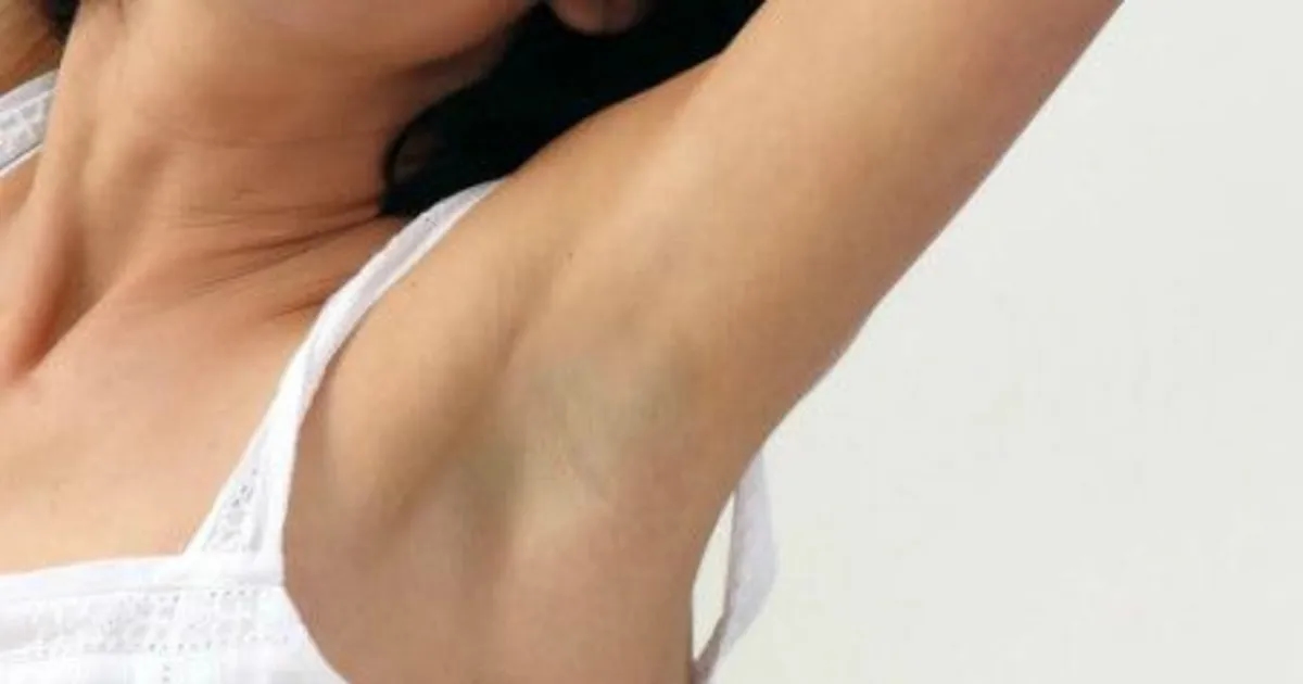 Guzek pod pachą czym smarować? Skuteczne sposoby na ulgę