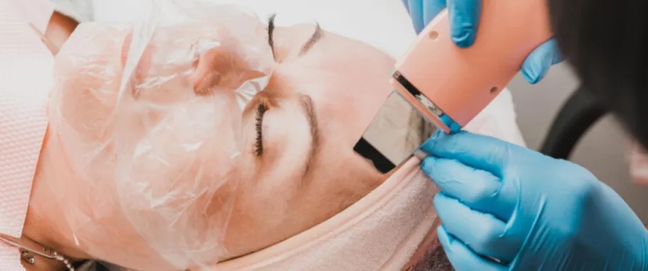 Co daje peeling kawitacyjny? Efekty, które Cię zaskoczą