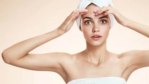 Jak ukryć pryszcze bez makijażu - naturalne metody na niedoskonałości