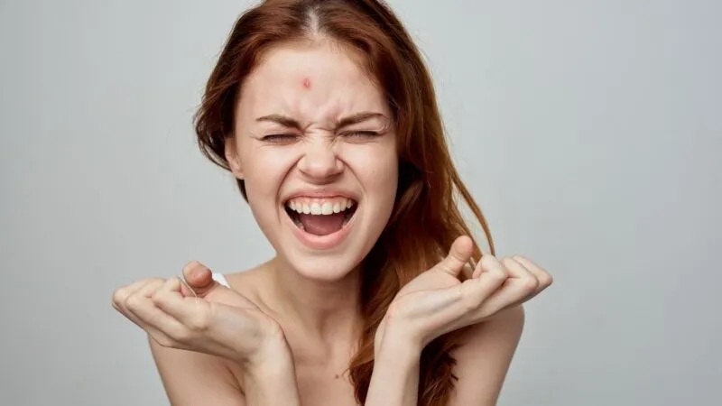 Jak pozbyć się pryszcza w jedną noc - szybkie i skuteczne metody