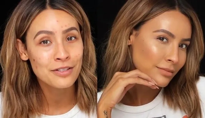 Jak zakryć pryszcze skutecznie i bezpiecznie - sprawdź te metody