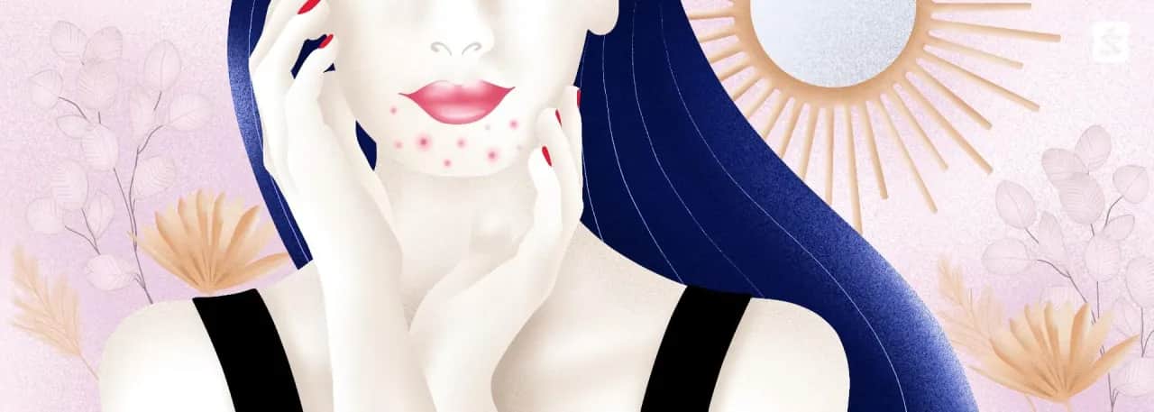 Od czego są pryszcze na brodzie i jak ich uniknąć w przyszłości