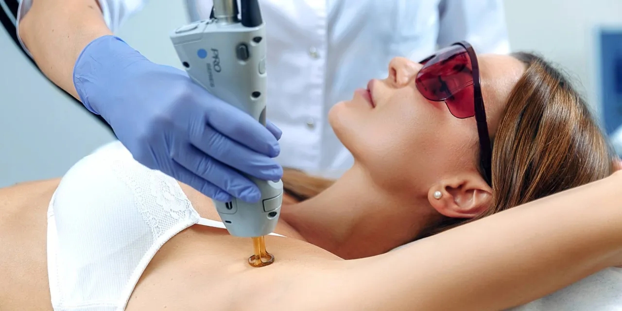 Ile zabiegów depilacji laserowej pachy potrzebujesz, aby być gładką?