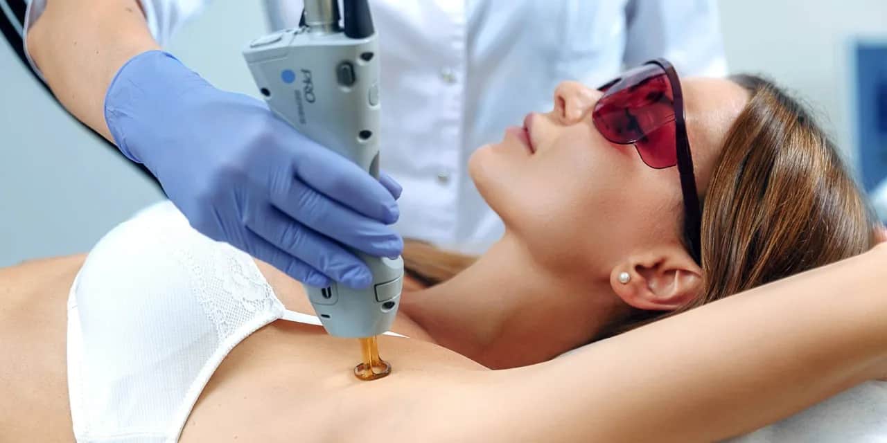 Ile zabiegów depilacji laserowej pachy potrzebujesz, aby być gładką?