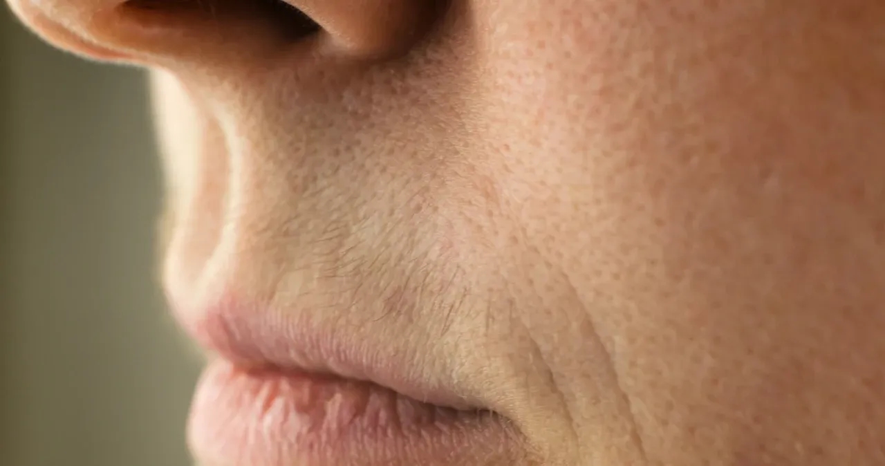 Jak usunąć wąsik żeby nie odrastał - skuteczne metody na trwałe efekty