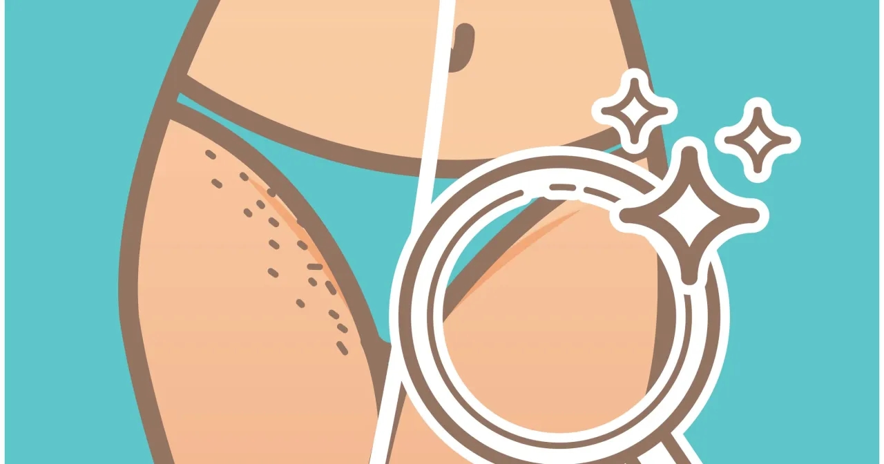 Czym golić bikini, aby uniknąć podrażnień i uzyskać idealny efekt