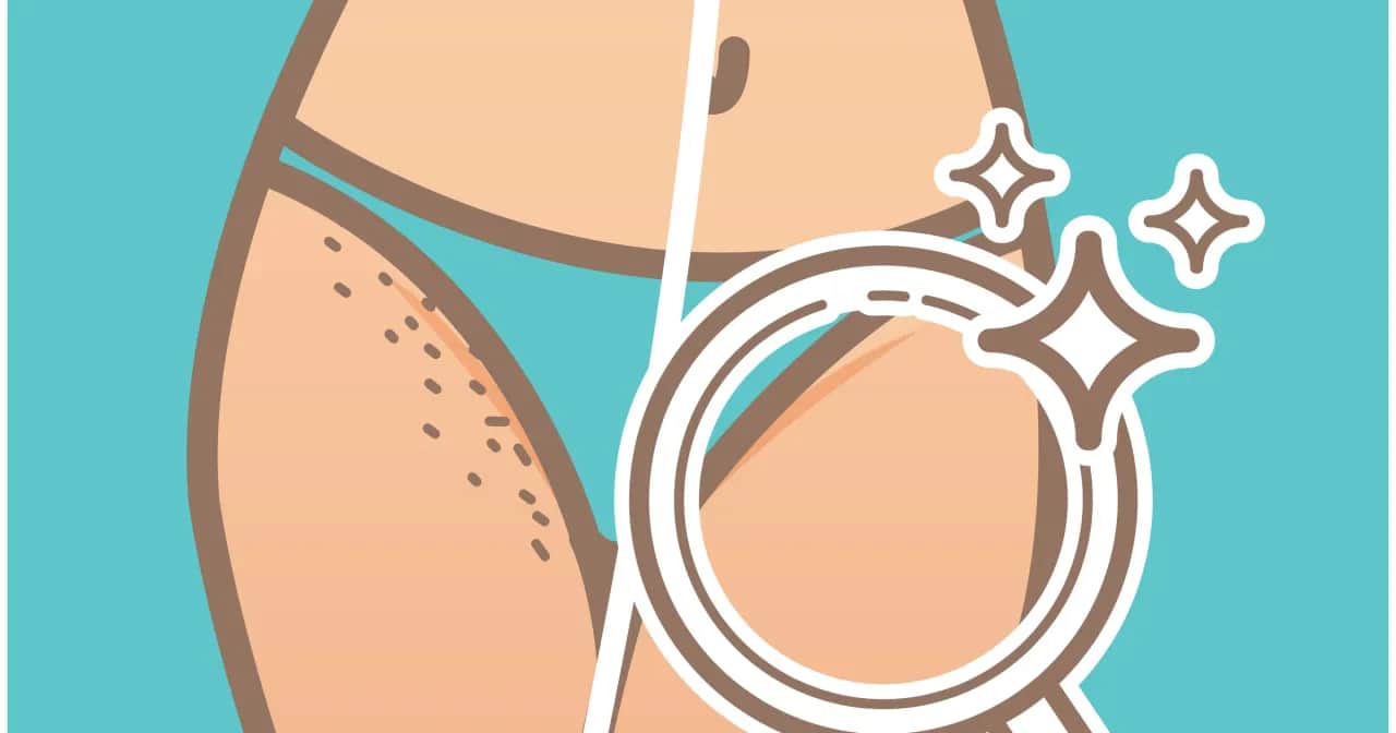 Czym golić bikini, aby uniknąć podrażnień i uzyskać idealny efekt