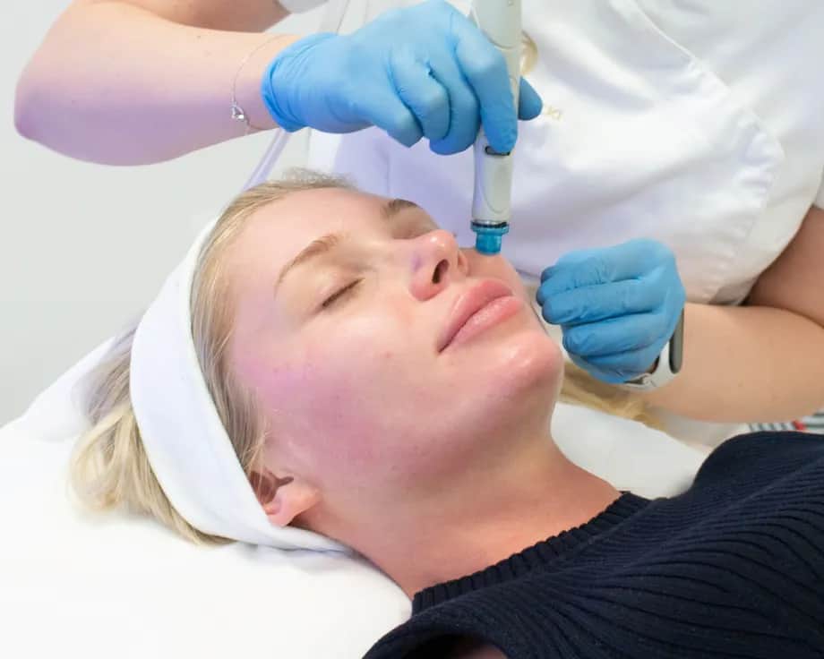 Czy po mikrodermabrazji schodzi skóra? Fakty, które musisz znać