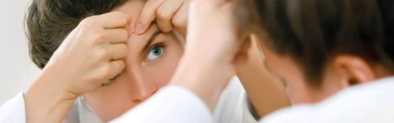 Czy powinno się wyciskać pryszcze? Poznaj ryzyko i lepsze metody pielęgnacji