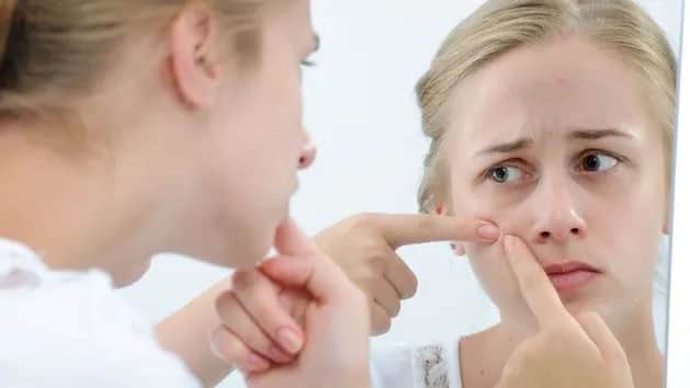 Jak wysuszyć pryszcze szybko i skutecznie - sprawdzone metody