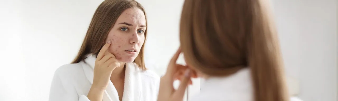 Kremy do cery suchej z wypryskami – jak wybrać najlepszy produkt