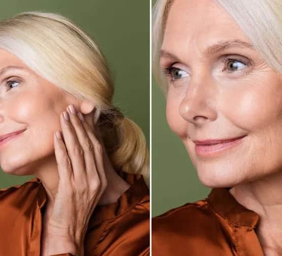 Ile zabiegów endermologii twarzy potrzebujesz dla najlepszych efektów?