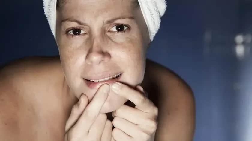 Czy pasta pomaga na pryszcze? Sprawdź, zanim zrobisz sobie krzywdę