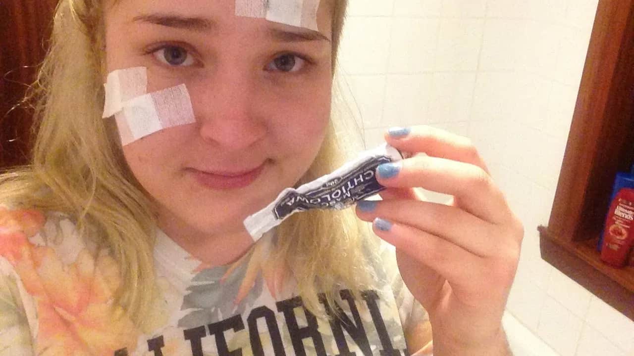 Jak stosować maść ichtiolową na pryszcze, aby uniknąć podrażnień