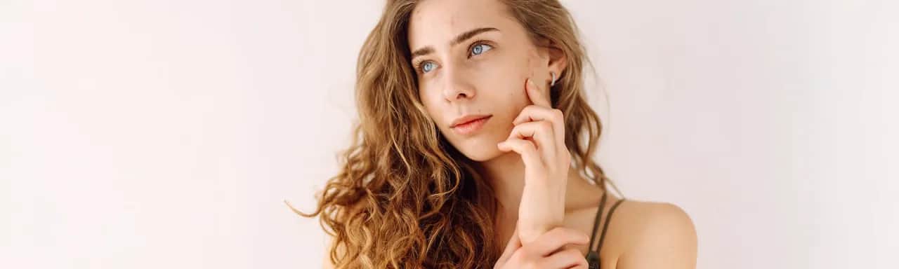 Jaki krem na pryszcze? Skuteczne rozwiązania na trądzik i problemy skórne